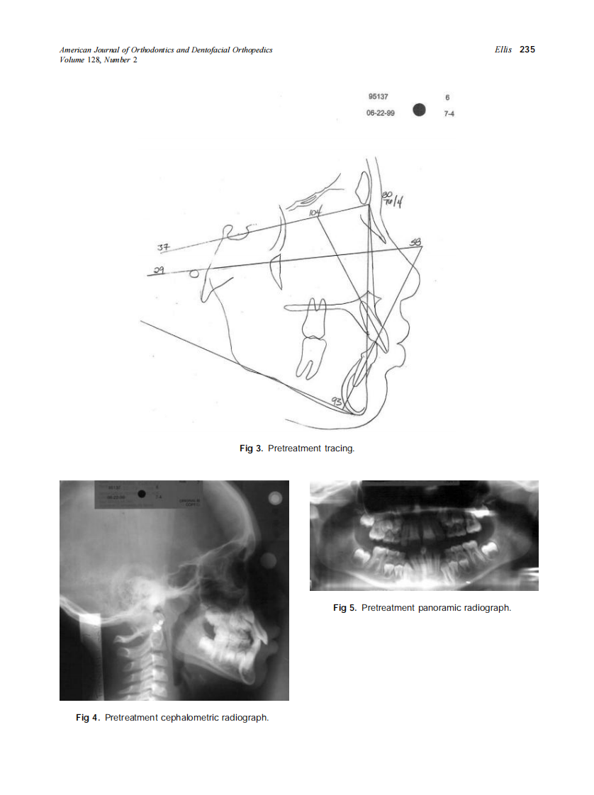 2005_128_2_231_240_Ellis.pdf 第5页