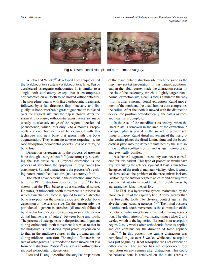 2005_128_3_388_396_Bilodeau.pdf 第5页