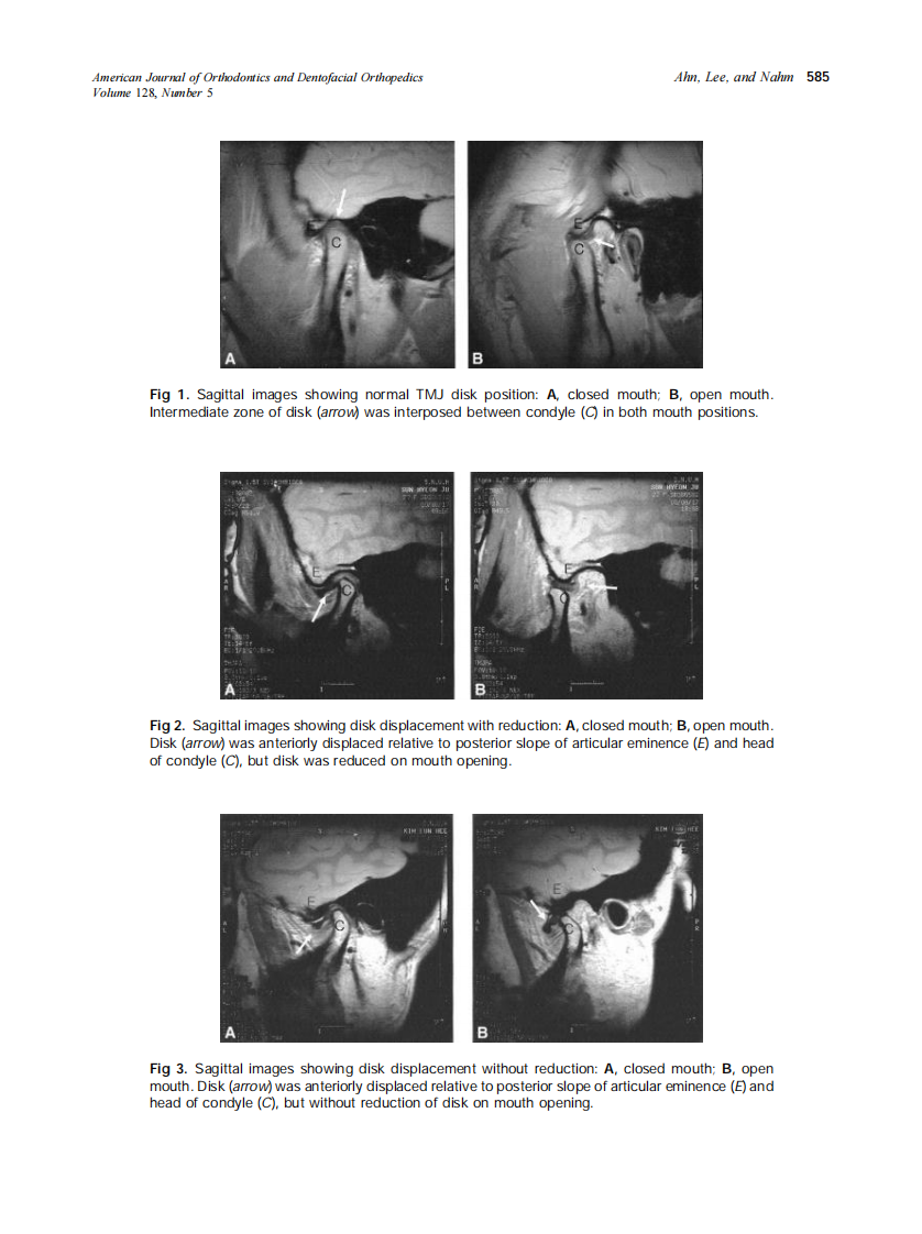 2005_128_5_583_591_Ahn.pdf 第3页