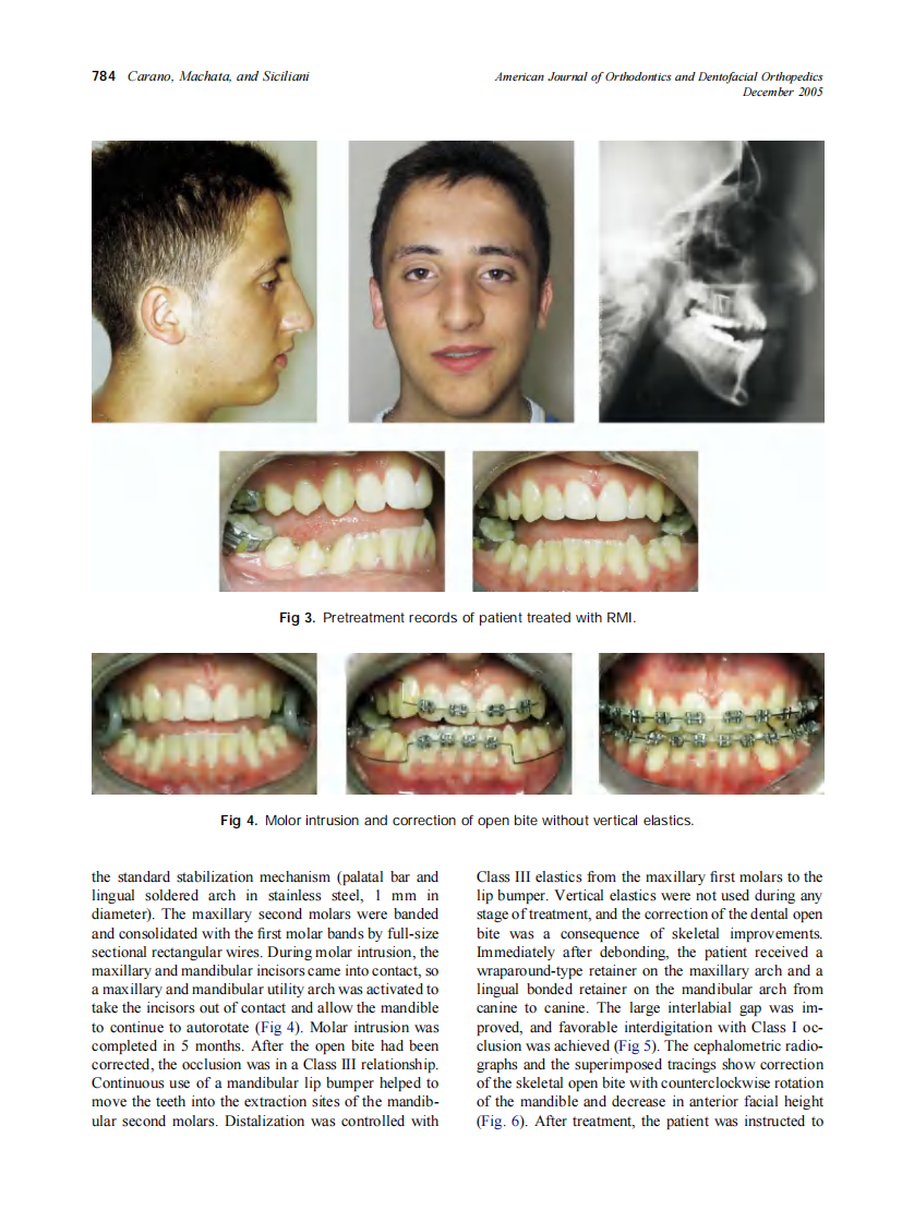 2005_128_6_781_786_Carano.pdf 第4页