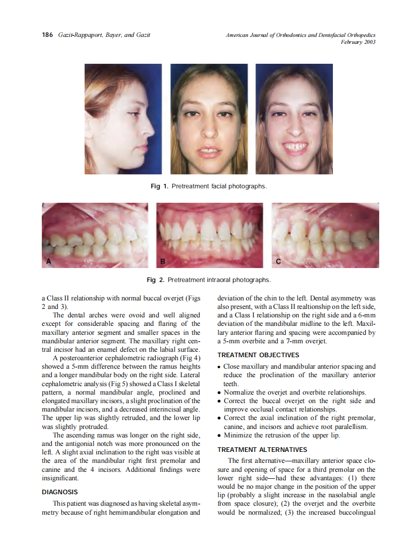 2003_123_2_185_191_Gazit-Rappaport.pdf 第2页