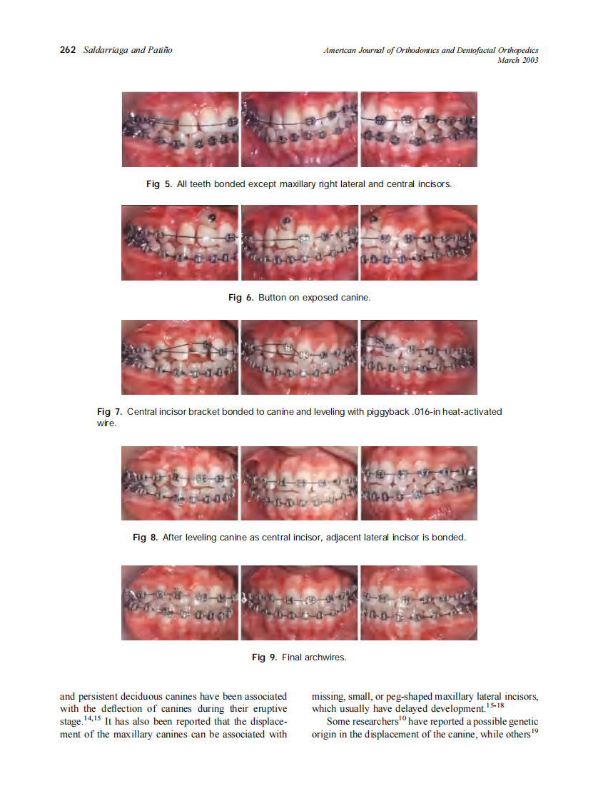 2003_123_3_259_265_Saldarriaga.pdf 第4页