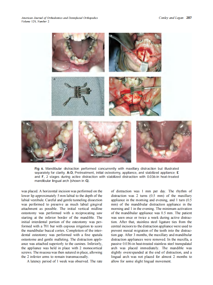 2006_129_2_283_292_Conley.pdf 第5页
