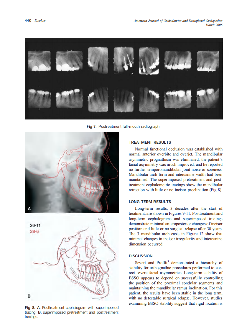 2006_129_3_436_443_Decker.pdf 第5页