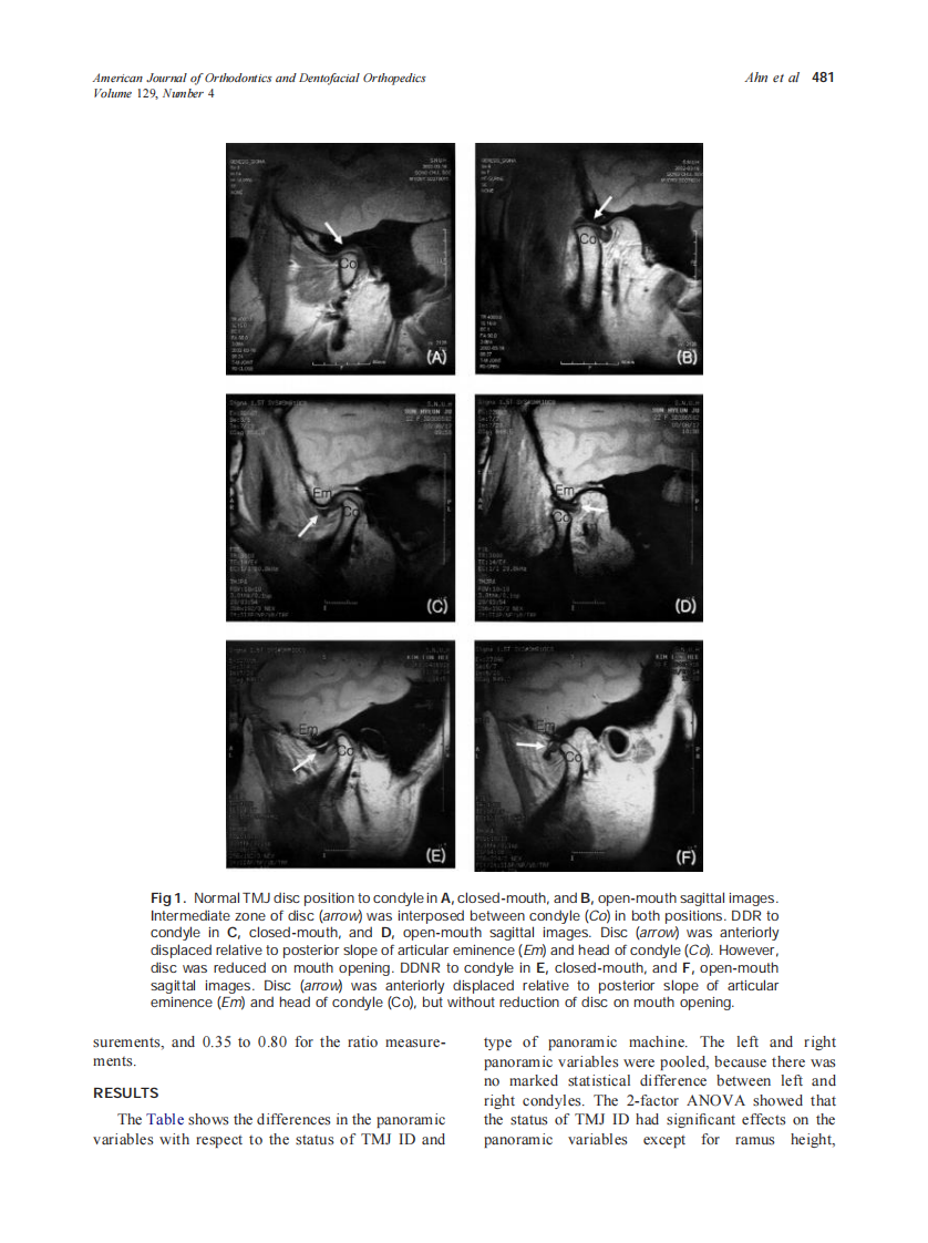 2006_129_4_479_485_Ahn.pdf 第3页