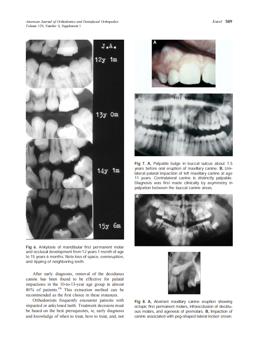 2006_129_4-Suppl-1_S86_S90_Kurol.pdf 第4页