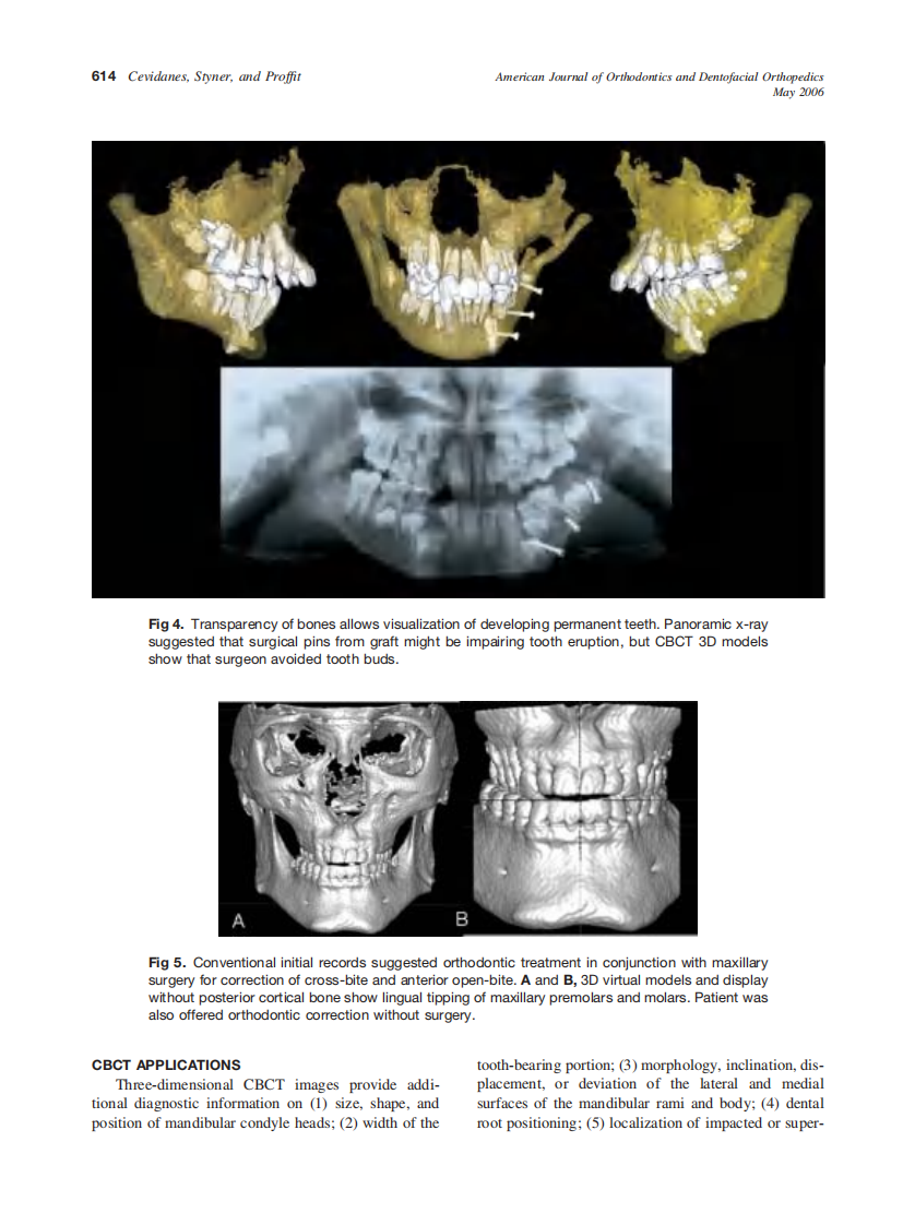 2006_129_5_611_618_Cevidanes.pdf 第4页