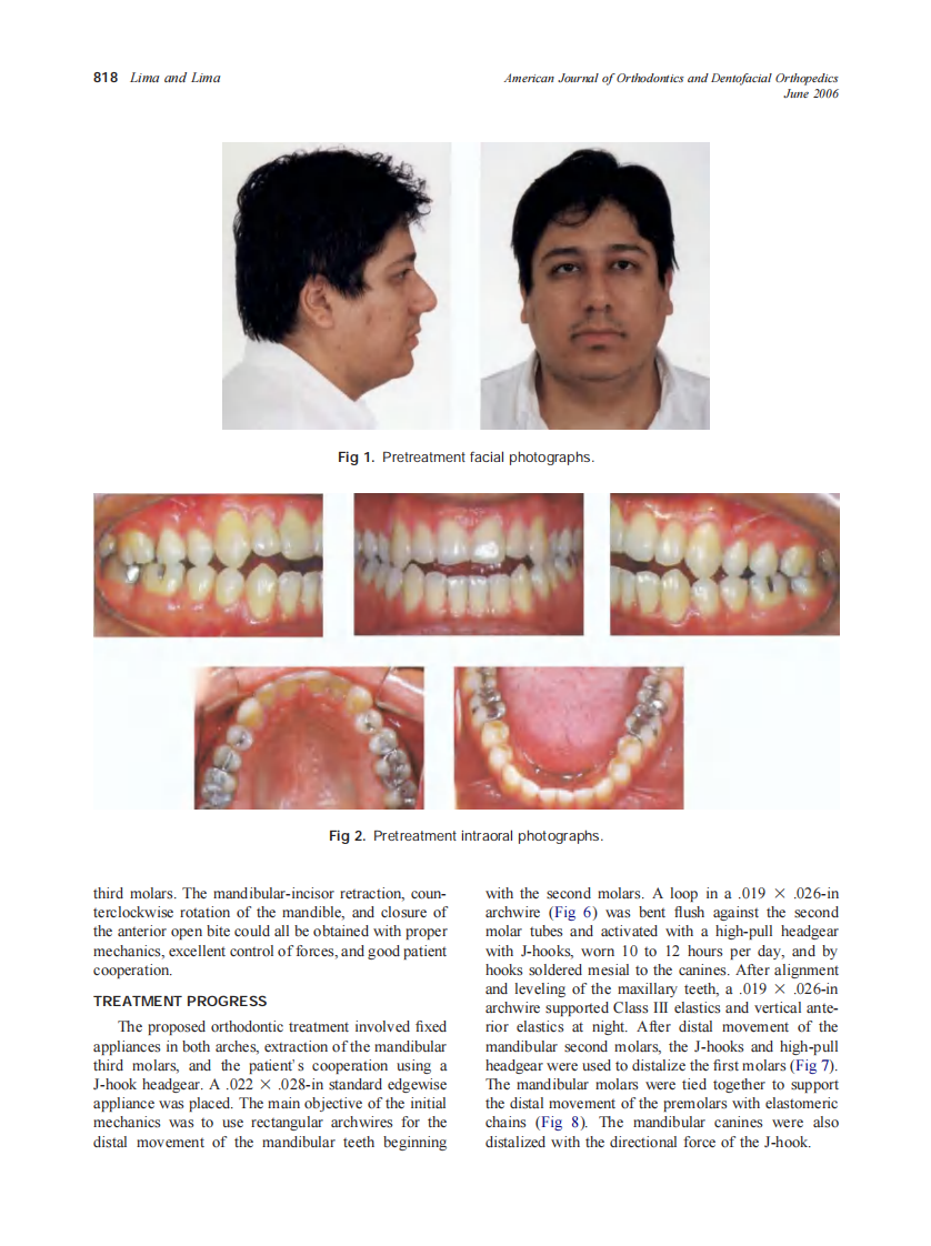 2006_129_6_817_824_Lima.pdf 第2页