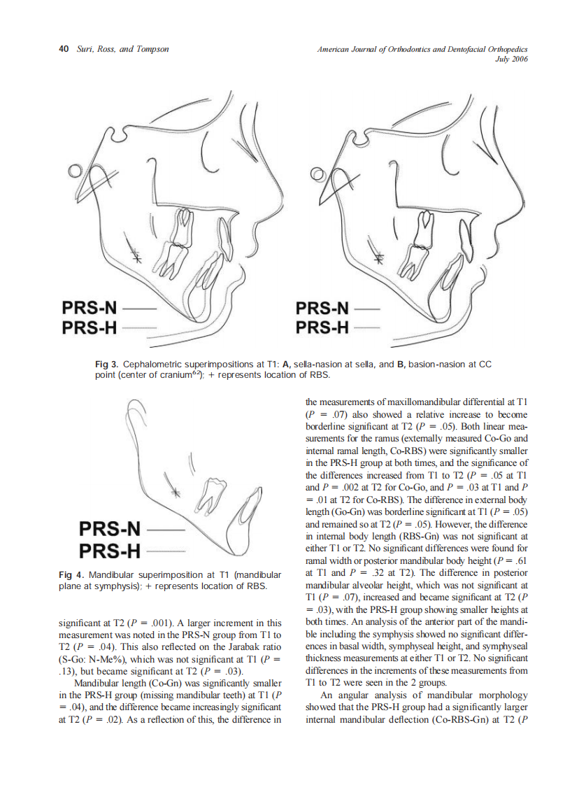 2006_130_1_37_46.e1_Suri.pdf 第4页