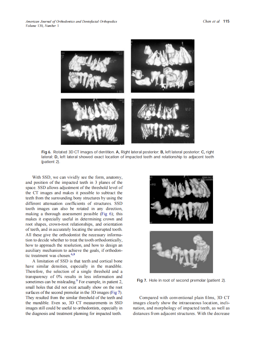 2006_130_1_112_116_Chen.pdf 第4页