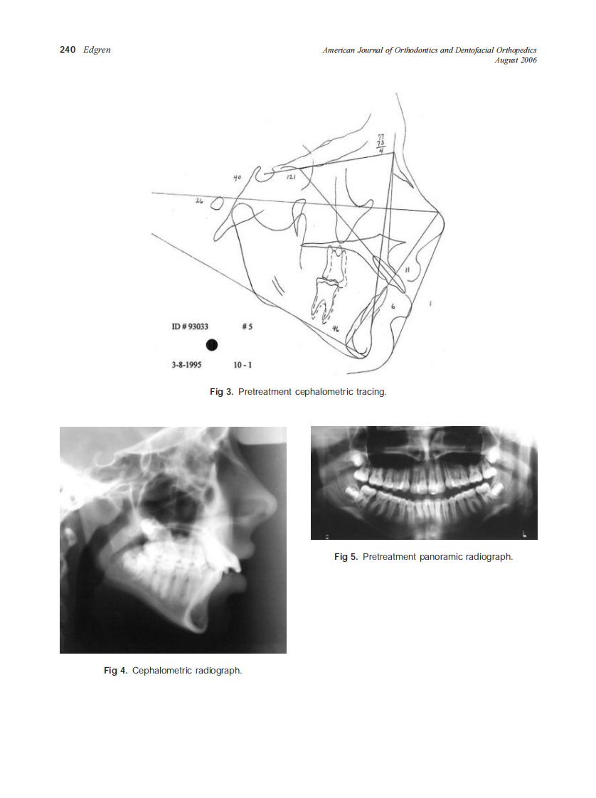 2006_130_2_236_243_Edgren.pdf 第5页