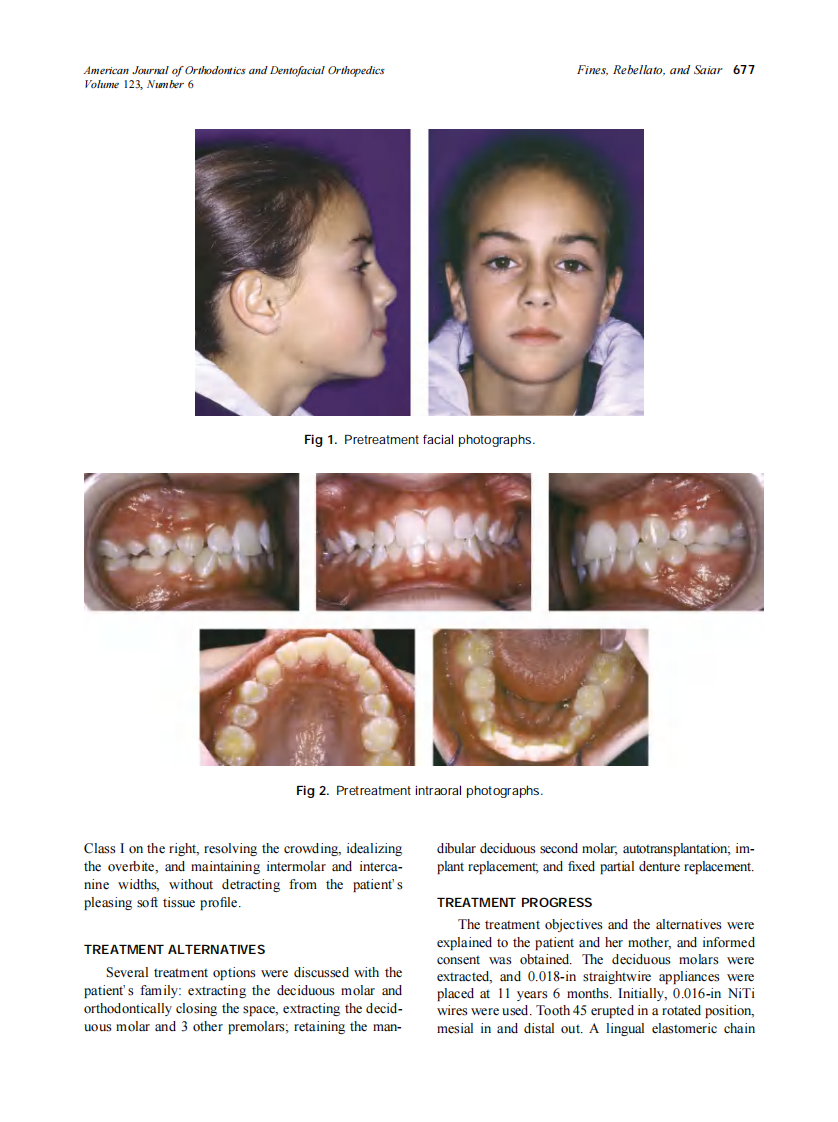 2003_123_6_676_682_Fines.pdf 第2页