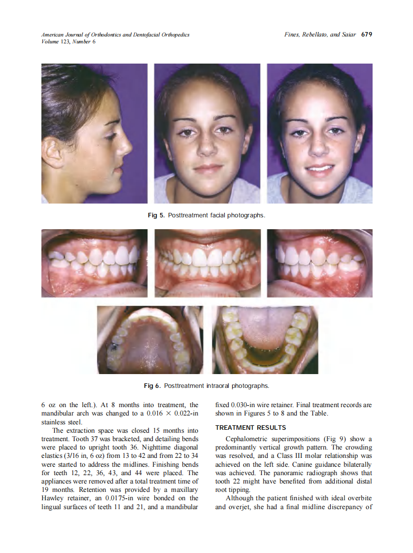 2003_123_6_676_682_Fines.pdf 第4页