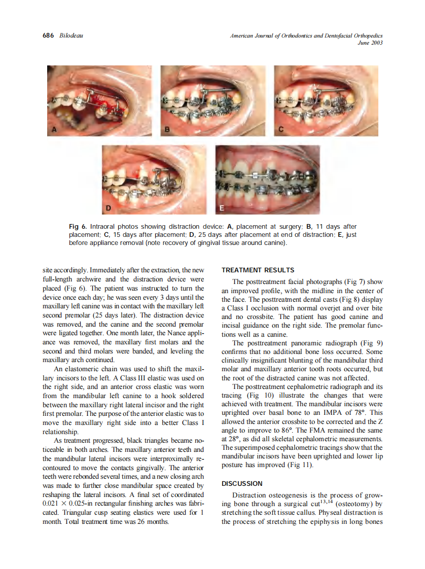2003_123_6_683_689_Bilodeau.pdf 第4页