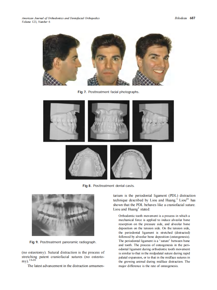 2003_123_6_683_689_Bilodeau.pdf 第5页