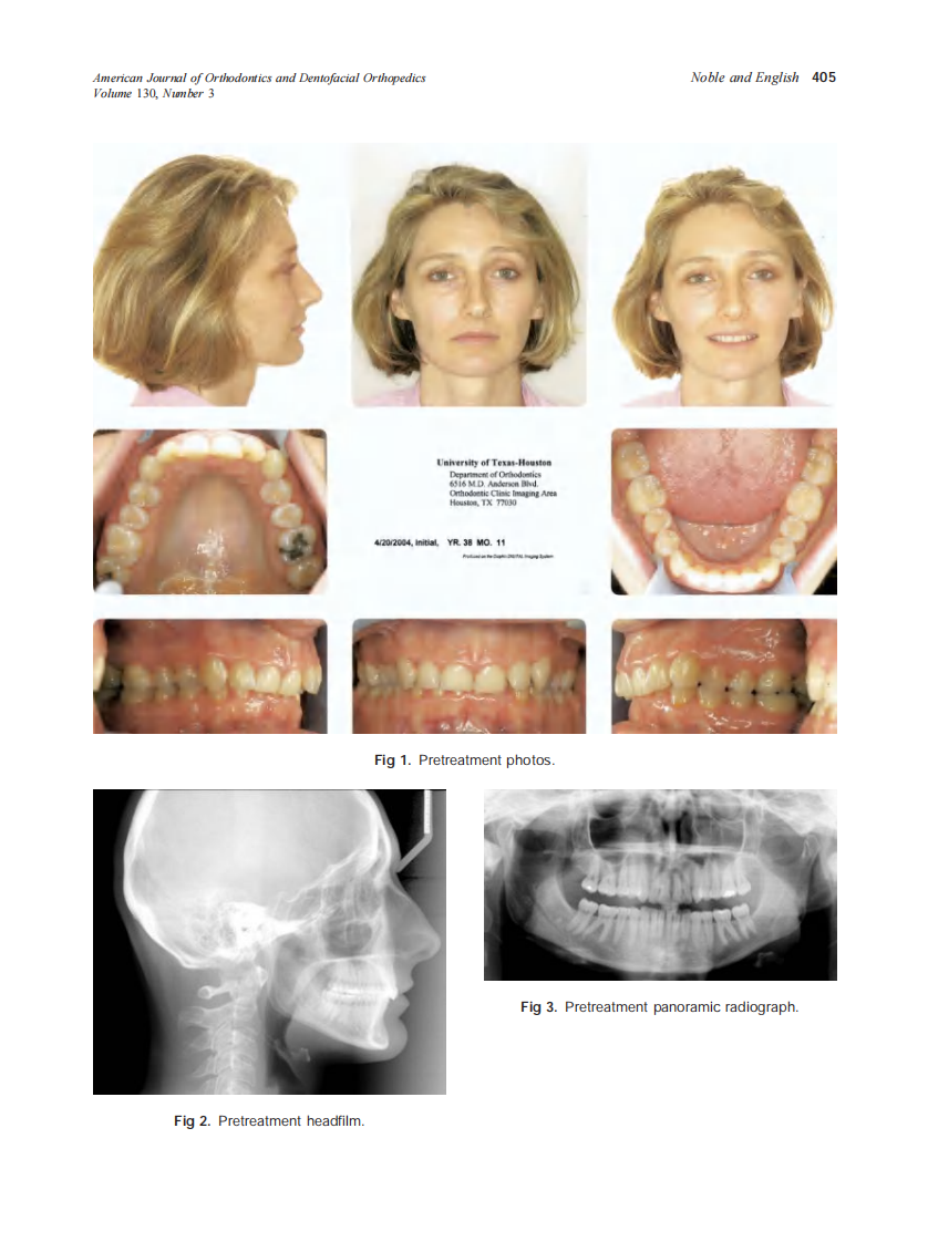 2006_130_3_403_408_Noble.pdf 第3页