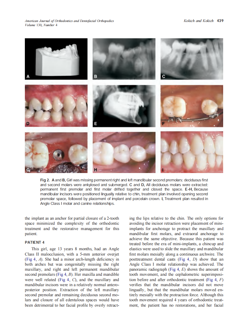 2006_130_4_437_444_Kokich.pdf 第3页
