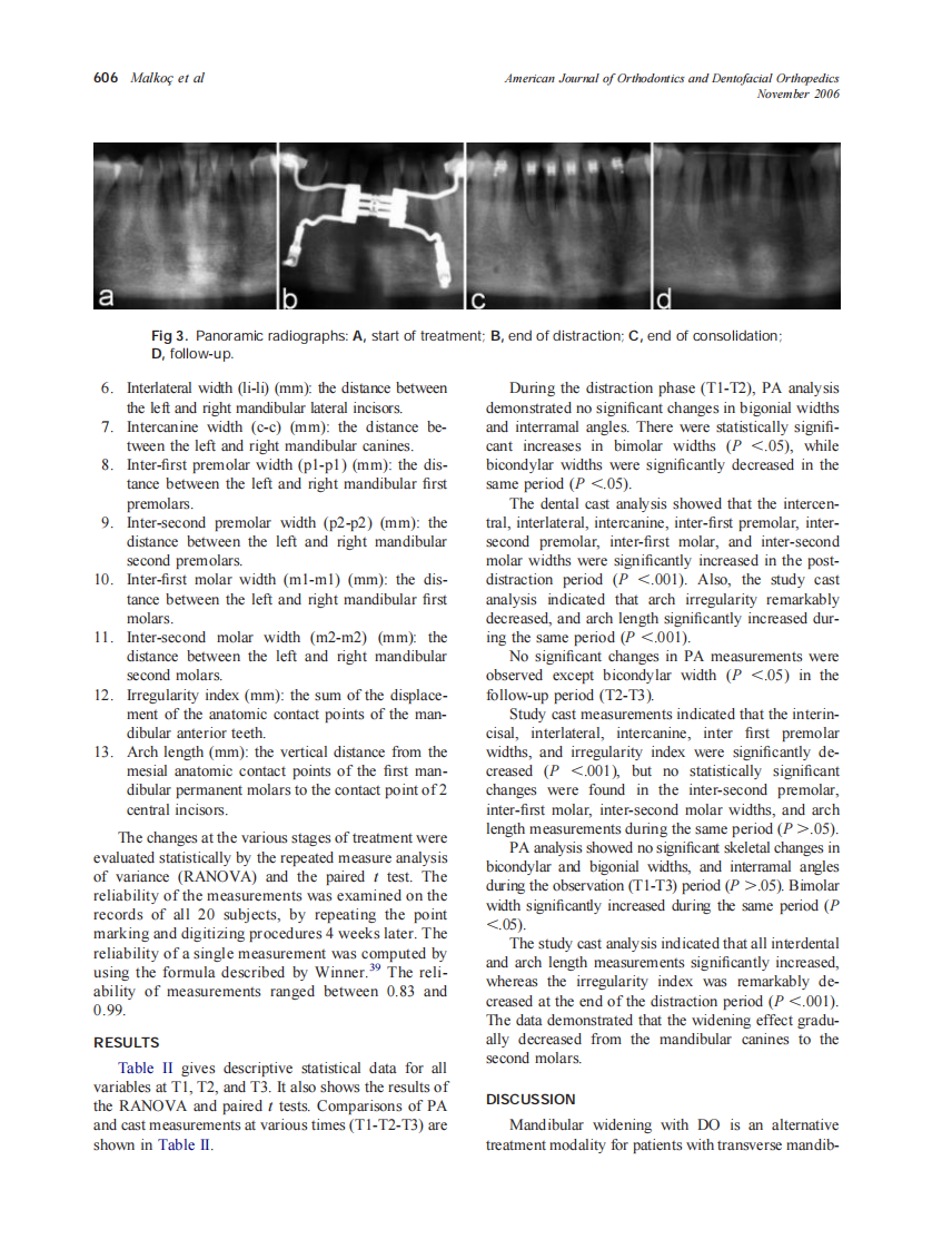 2006_130_5_603_611_Malkoc.pdf 第4页