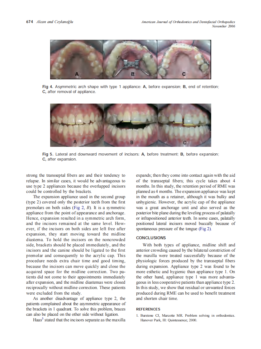 2006_130_5_671_675_Alcan.pdf 第4页