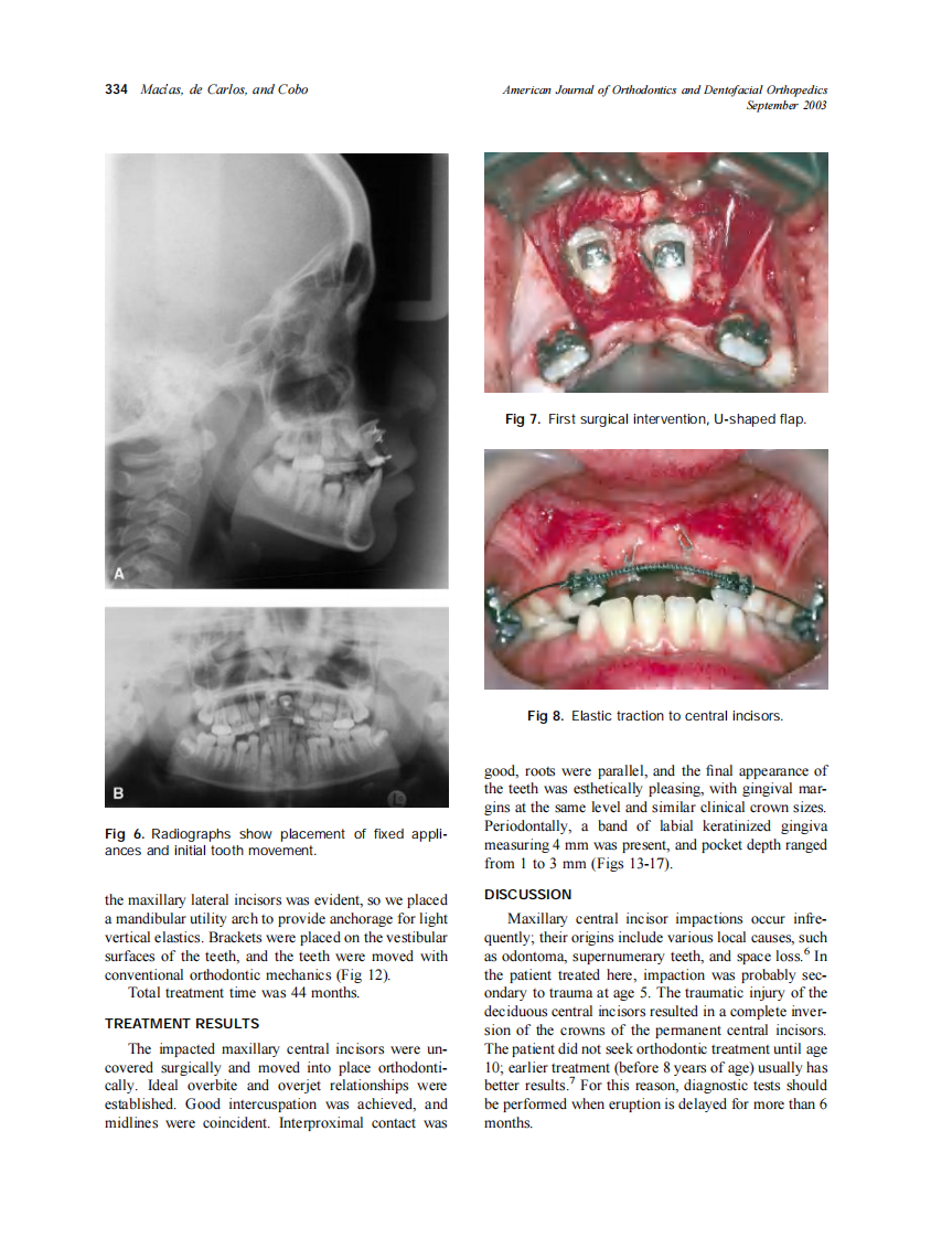 2003_124_3_331_338_Macias.pdf 第4页