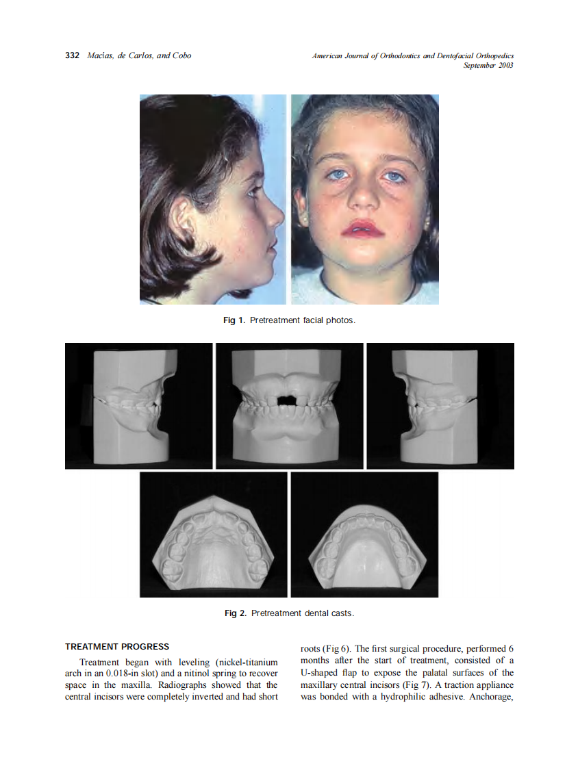 2003_124_3_331_338_Macias.pdf 第2页
