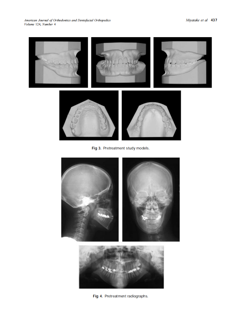 2003_124_4_435_445_Miyatake.pdf 第3页