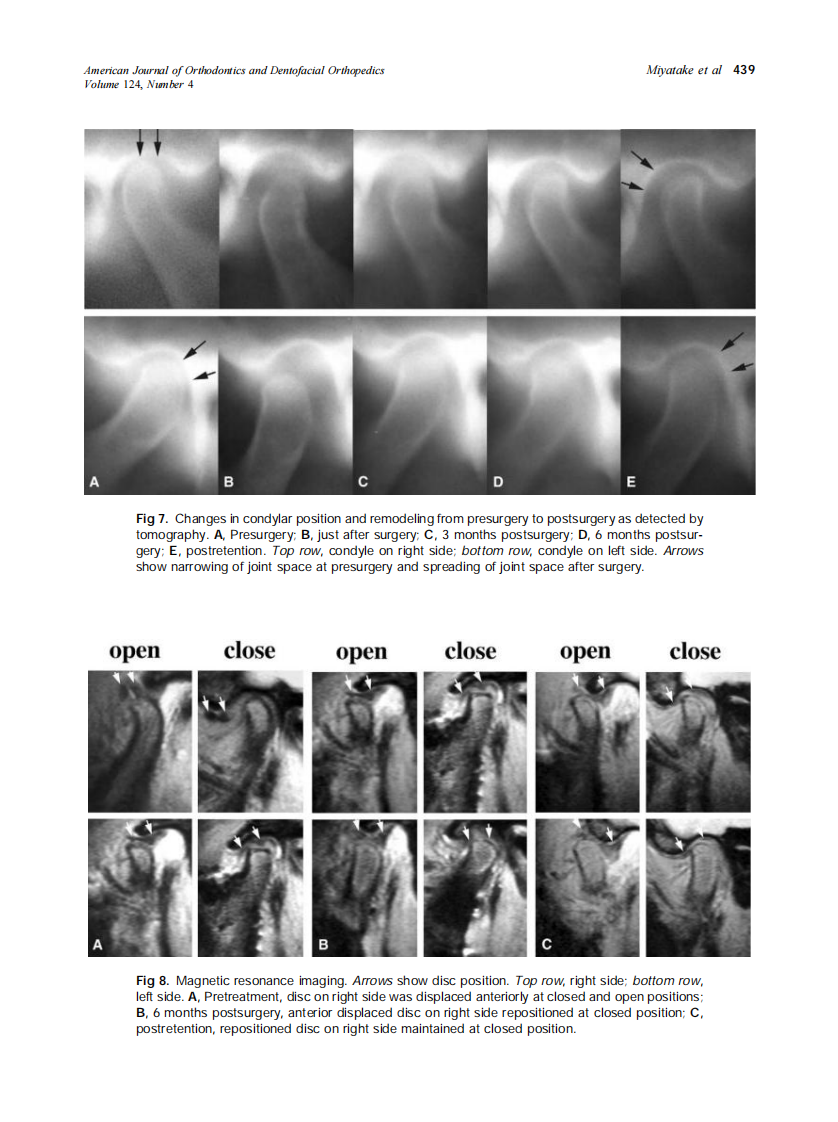 2003_124_4_435_445_Miyatake.pdf 第5页