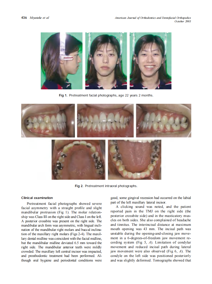 2003_124_4_435_445_Miyatake.pdf 第2页