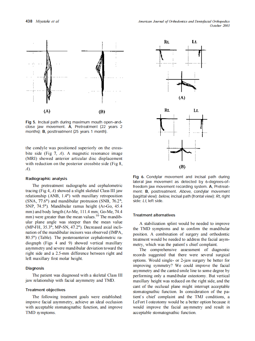 2003_124_4_435_445_Miyatake.pdf 第4页