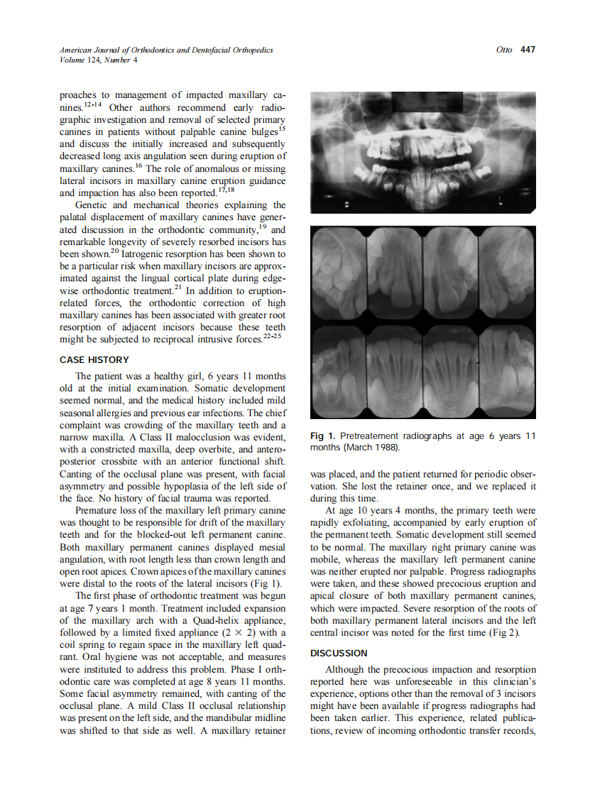 2003_124_4_446_449_Otto.pdf 第2页