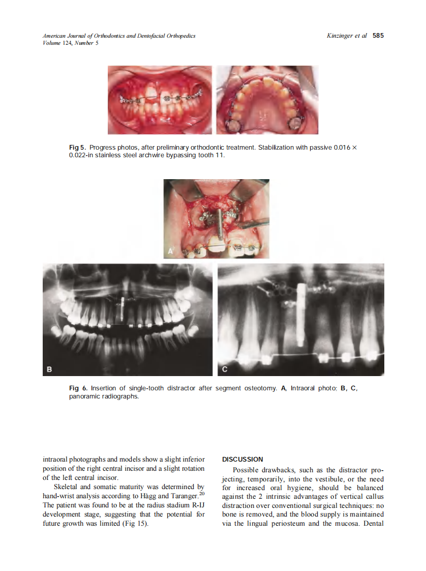 2003_124_5_582_590_Kinzinger.pdf 第4页