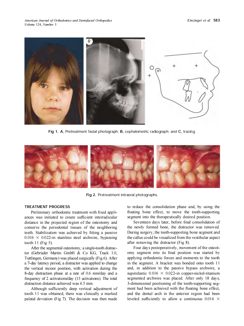 2003_124_5_582_590_Kinzinger.pdf 第2页