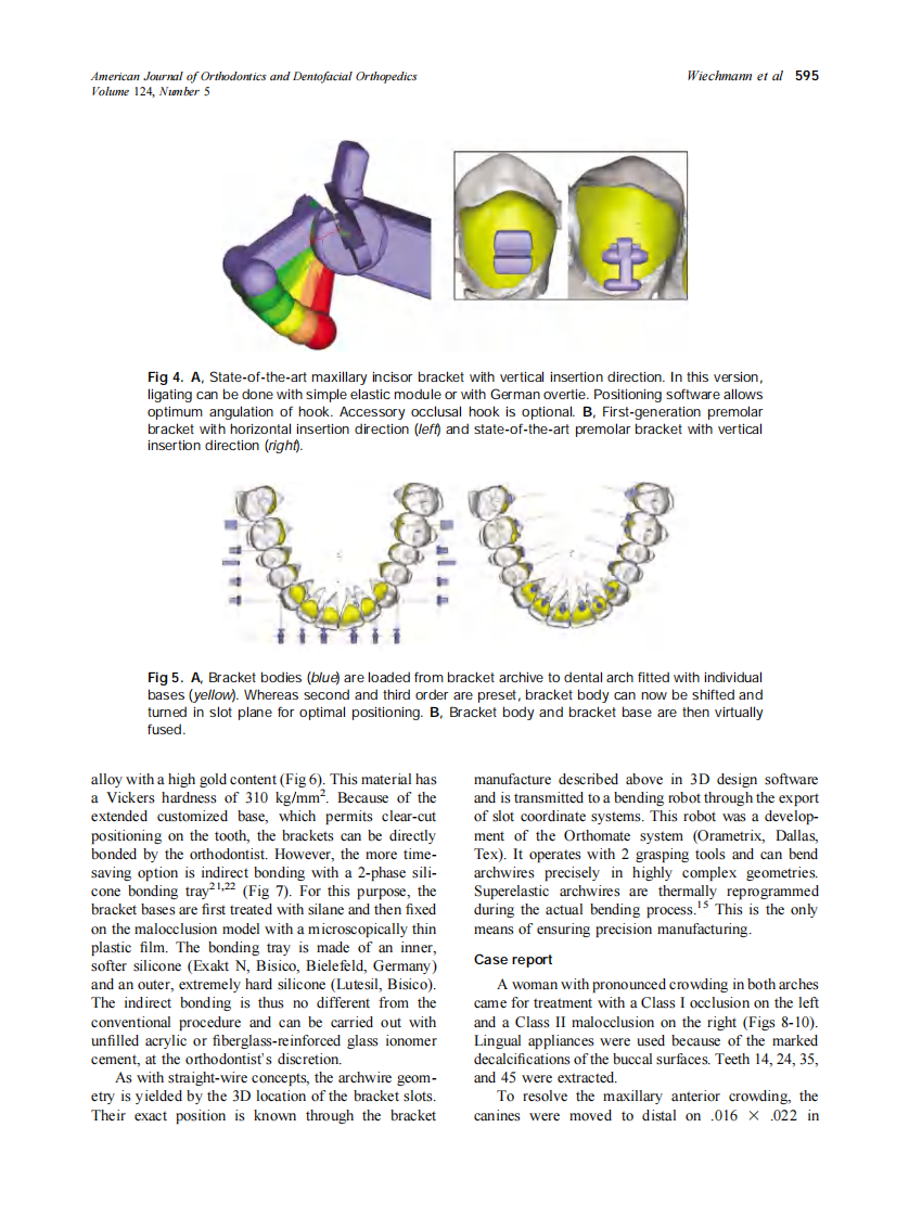 2003_124_5_593_599_Wiechmann.pdf 第3页