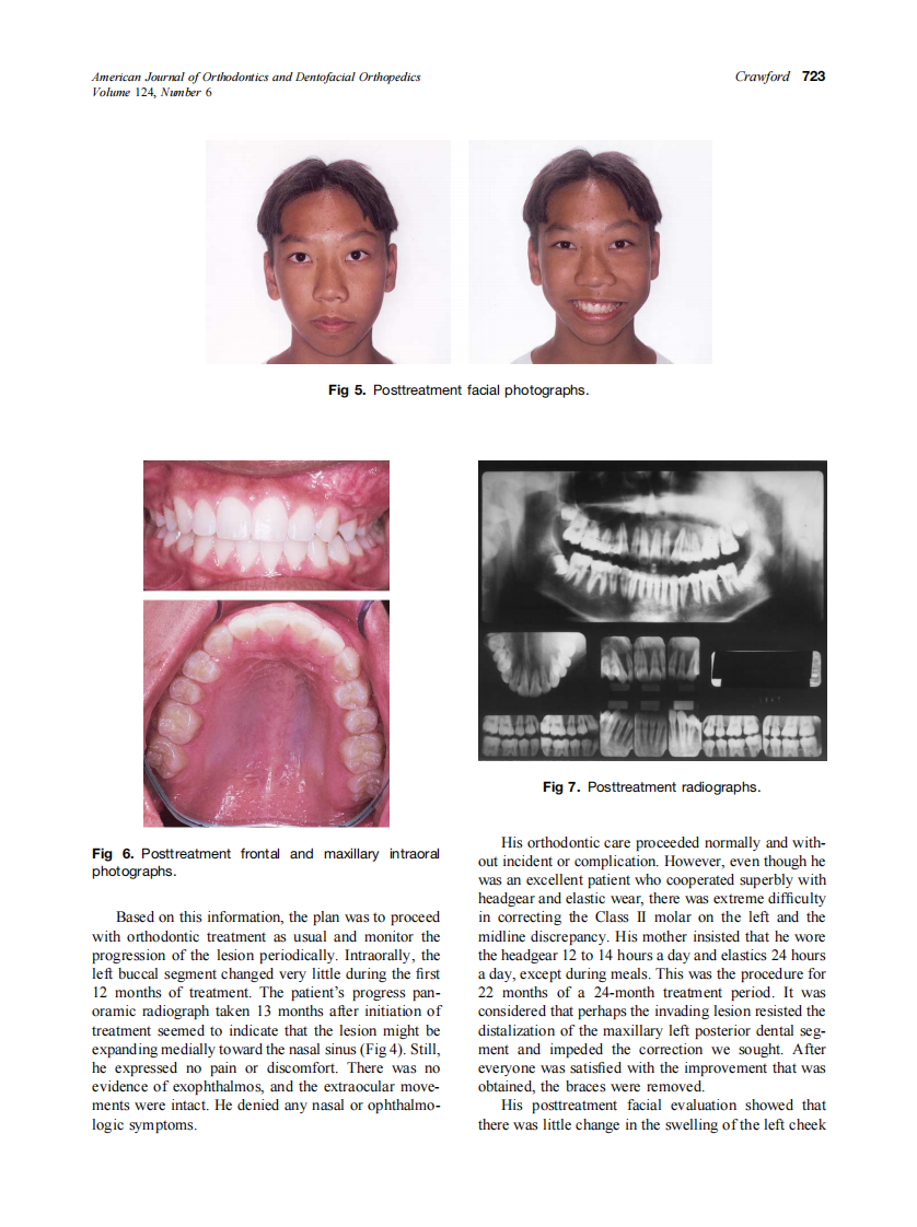 2003_124_6_721_724_Crawford.pdf 第3页