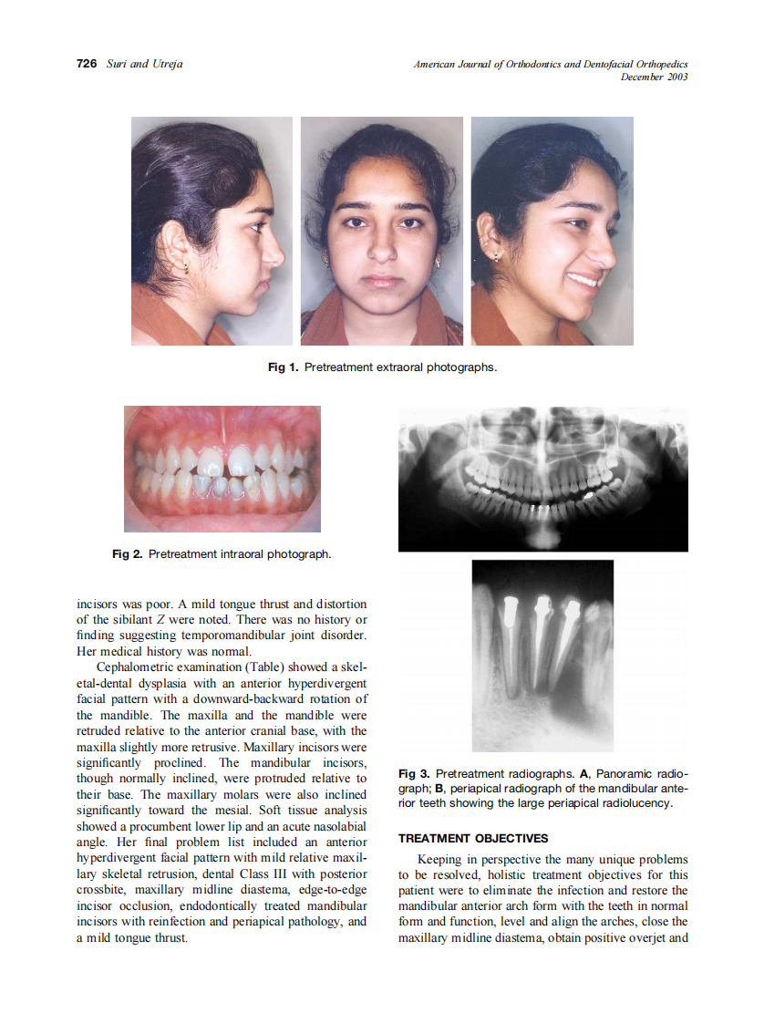2003_124_6_725_734_Suri.pdf 第2页