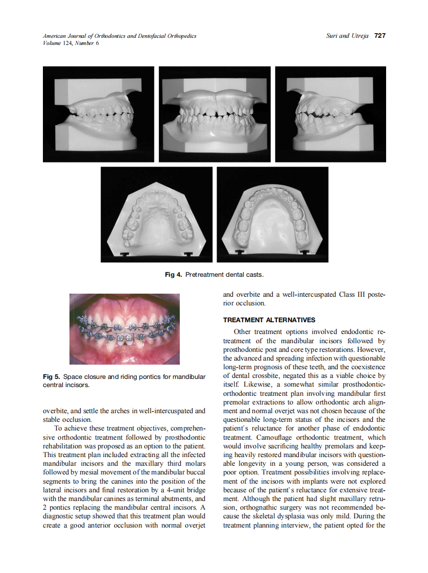2003_124_6_725_734_Suri.pdf 第3页
