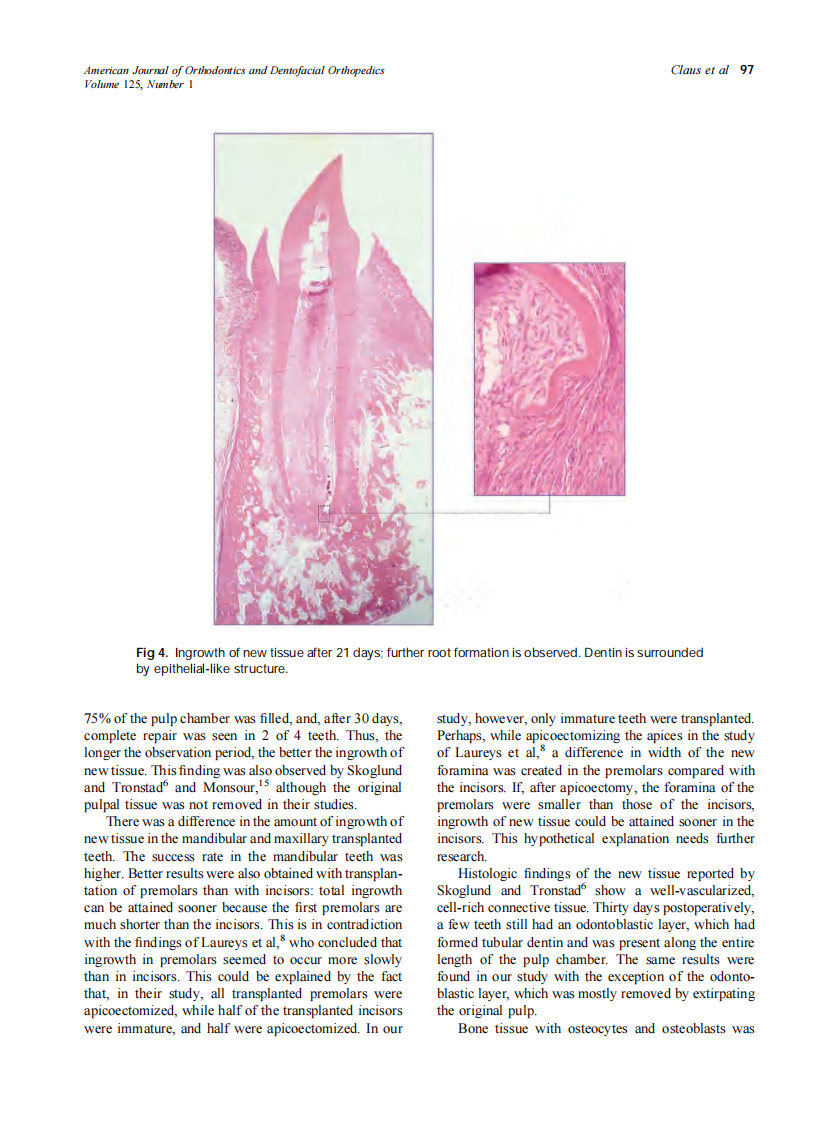 2004_125_1_93_99_Claus.pdf 第5页