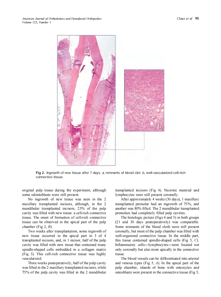 2004_125_1_93_99_Claus.pdf 第3页