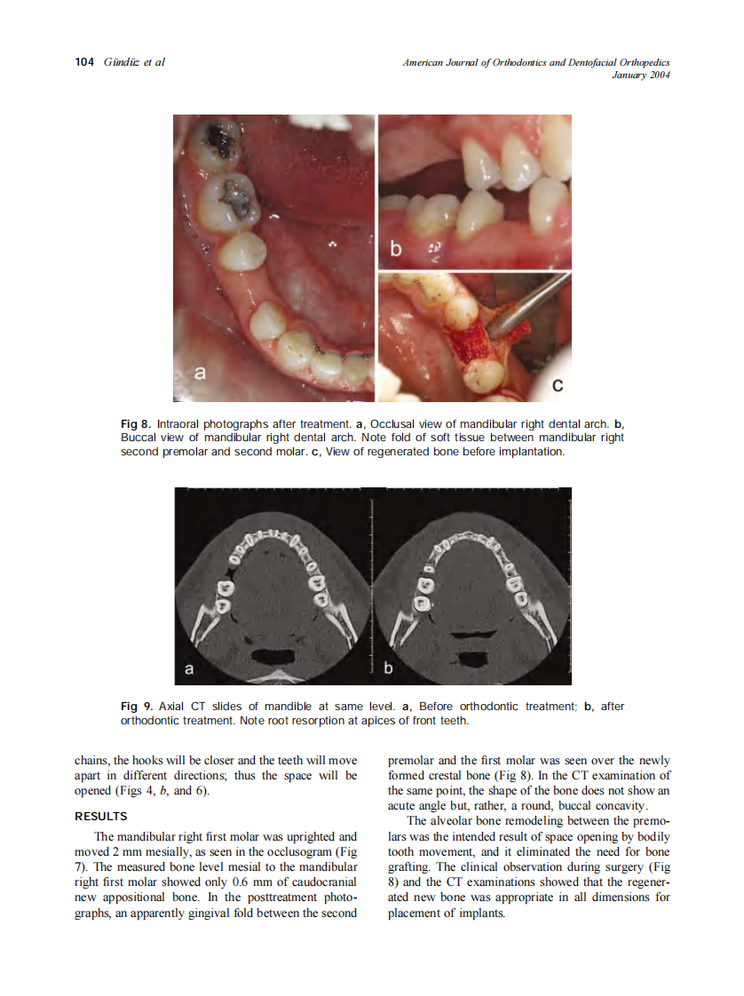 2004_125_1_100_106_Gunduz.pdf 第5页