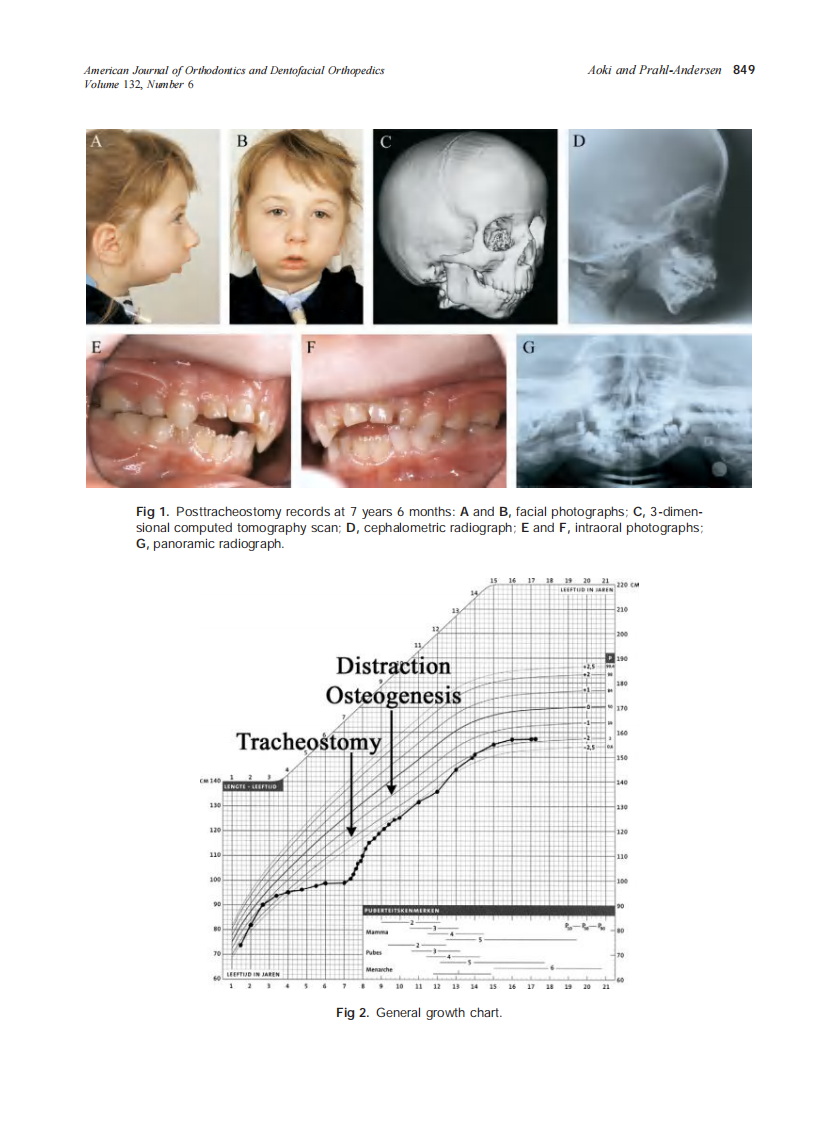 2007_132_6_848_855_Aoki.pdf 第2页
