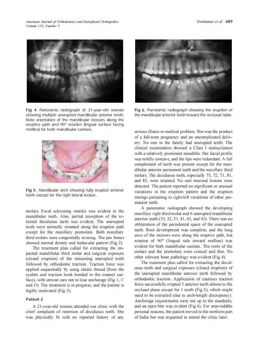 2007_132_5_687_692_Sivakumar.pdf 第3页