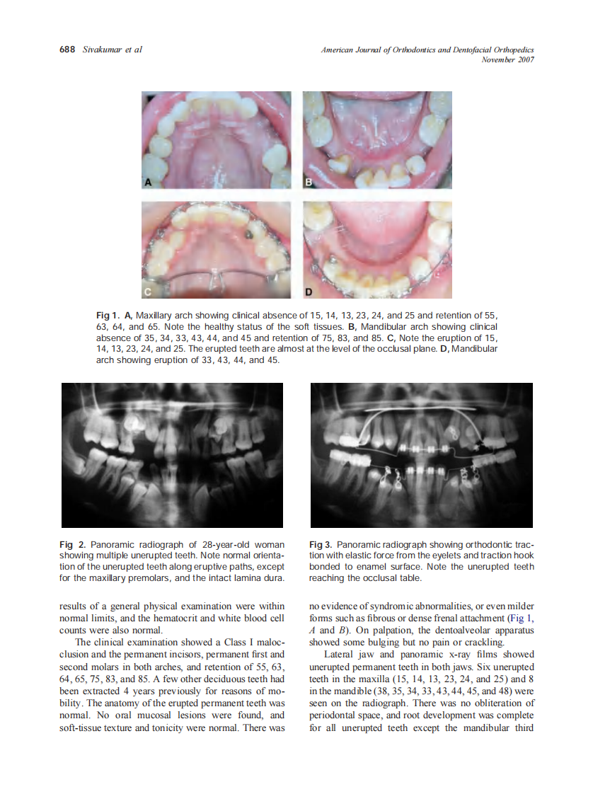 2007_132_5_687_692_Sivakumar.pdf 第2页