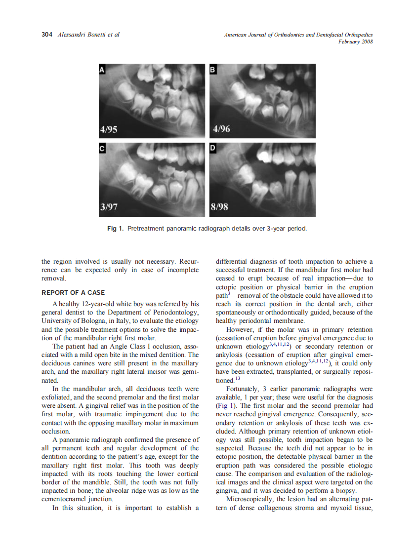 2008_133_2_303_307_Alessandri-Bonetti.pdf 第2页