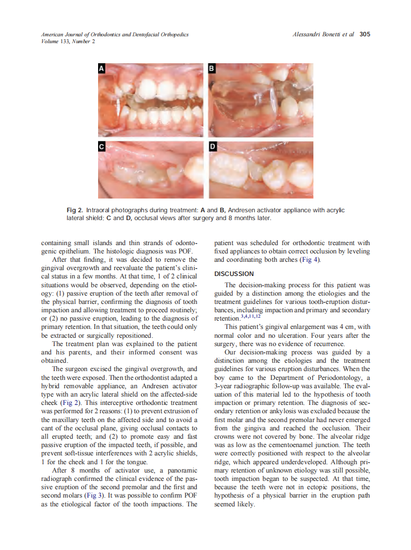 2008_133_2_303_307_Alessandri-Bonetti.pdf 第3页