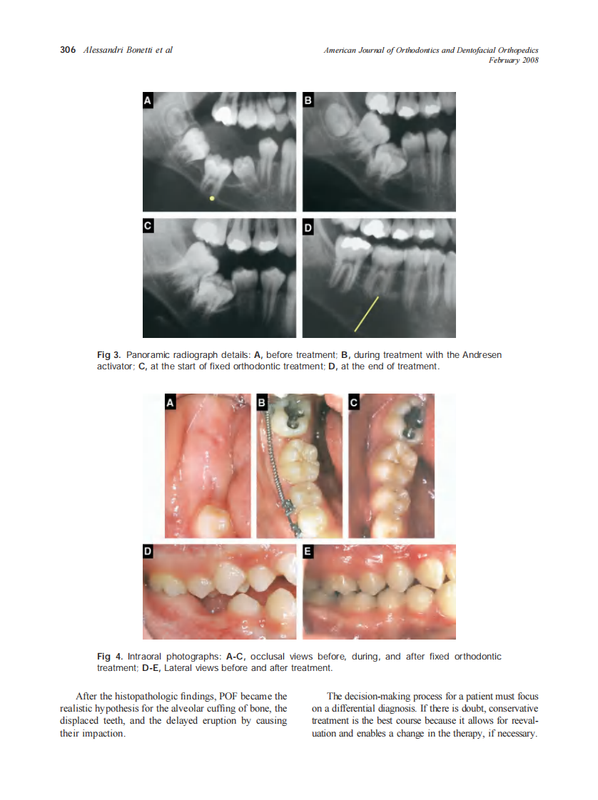 2008_133_2_303_307_Alessandri-Bonetti.pdf 第4页