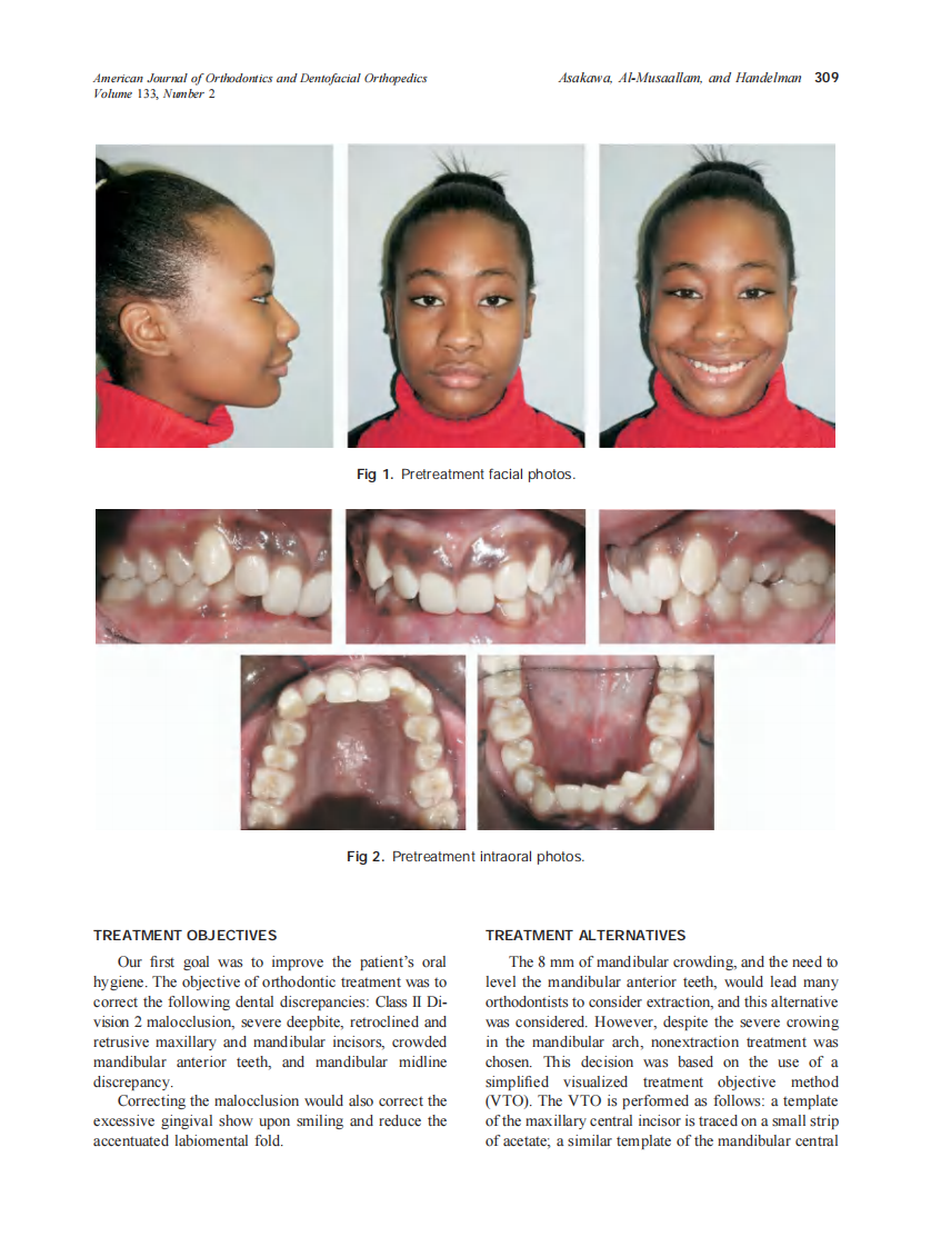2008_133_2_308_316_Asakawa.pdf 第2页