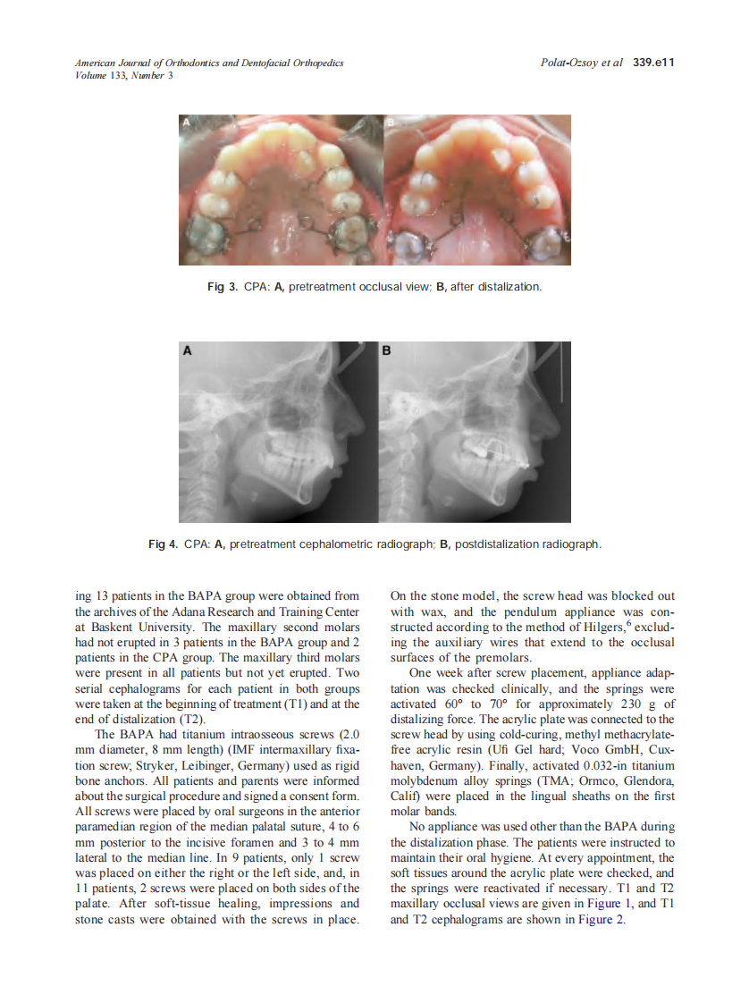 2008_133_3_339.e9_339.e17_Polat-Ozsoy.pdf 第3页