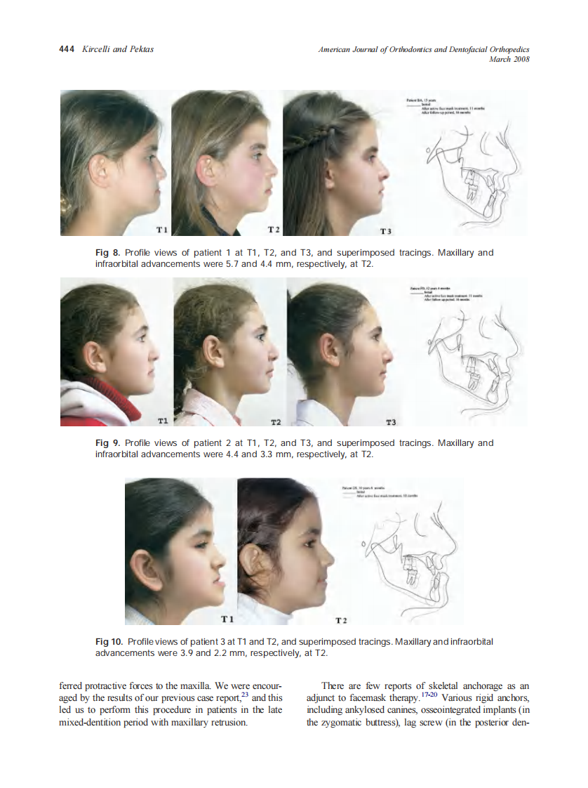 2008_133_3_440_449_Kircelli.pdf 第5页