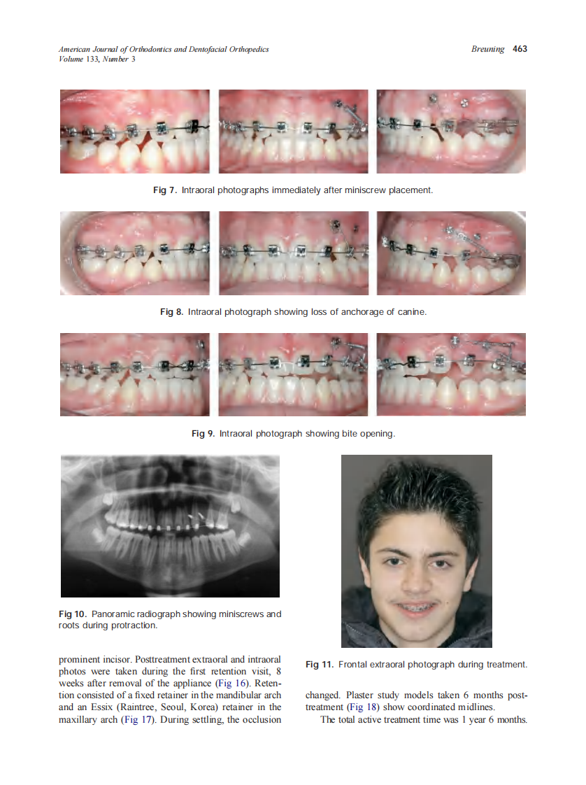 2008_133_3_459_469_Breuning.pdf 第5页