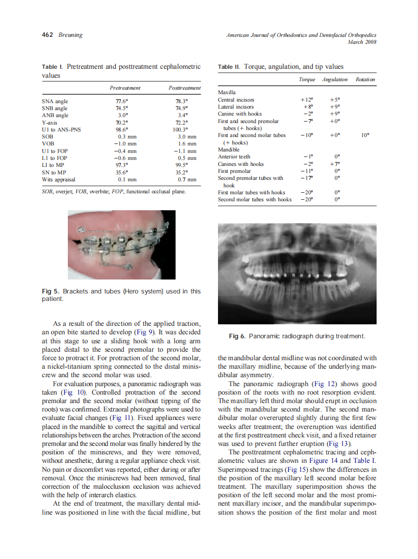 2008_133_3_459_469_Breuning.pdf 第4页
